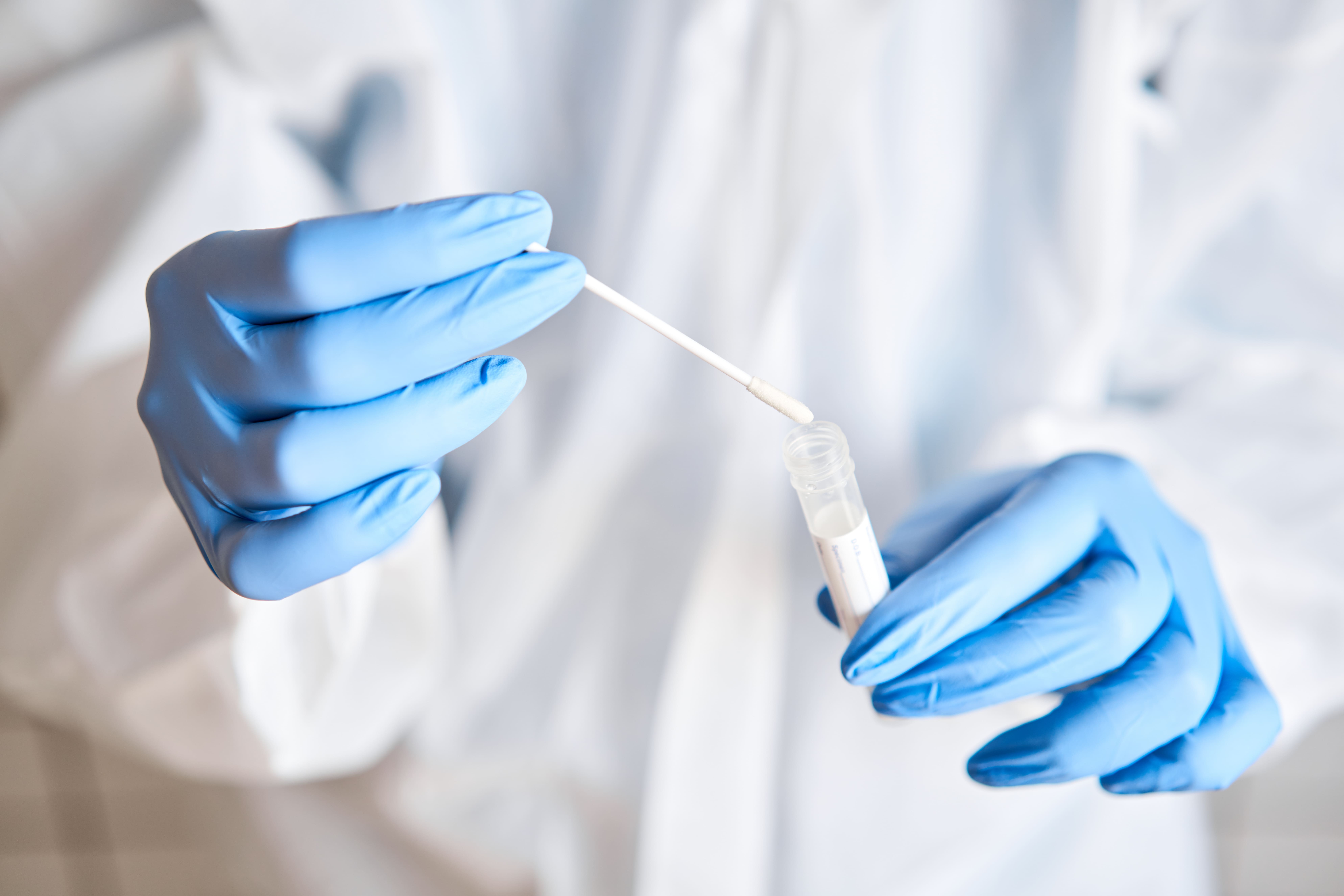 Imagen Muestreo indicadores higiénico sanitario